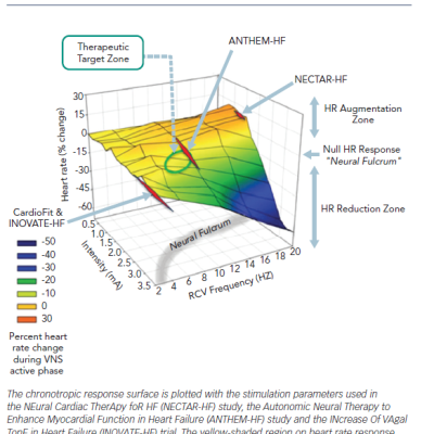 Figure 3 Clinical Application of the Vagus Nerve Stimulation Neural Fulcrum