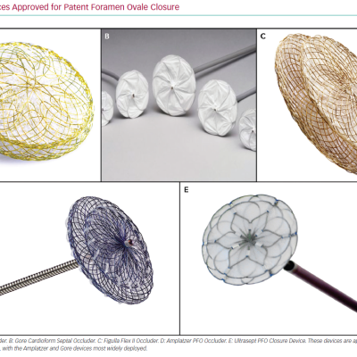 Devices Approved for Patent Foramen Ovale Closure