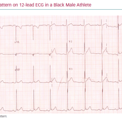 Early Repolarisation Pattern on 12-lead ECG in a Black Male Athlete