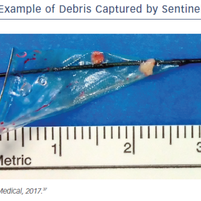 figure 3-example-of-debris