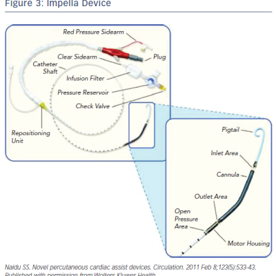 Figure 3 Impella Device