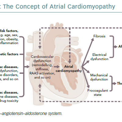 The Concept of Atrial Cardiomyopathy