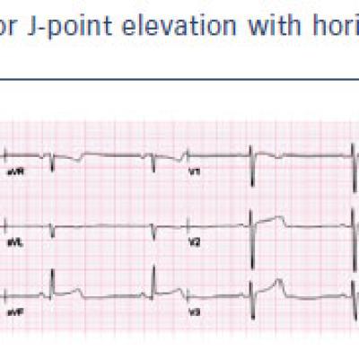 Expert Recommendations for the Diagnosis of ER Pattern and Syndrome19