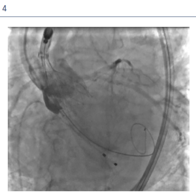 Figure4