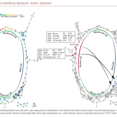 The Patient-similarity Network Aortic Stenosis