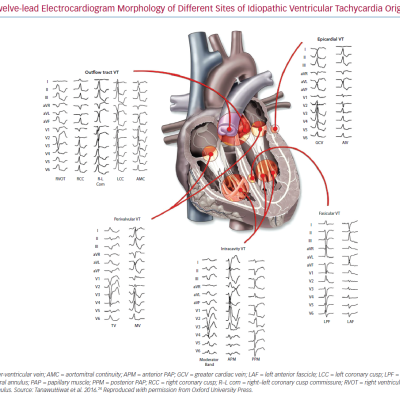 Twelve-lead Electrocardiogram Morphology