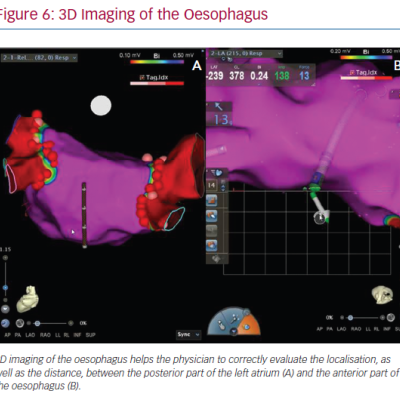 3D Imaging of the Oesophagus