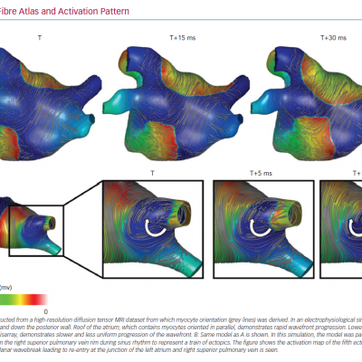 Atrial Fibre Atlas and Activation Pattern