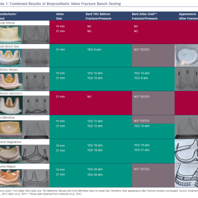 Table 1 Combined Results of Bioprosthetic Valve Fracture Bench Testing