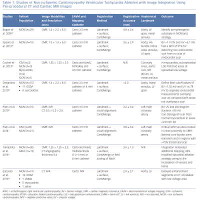 Studies of Non-ischaemic Cardiomyopathy Ventricular Tachycardia