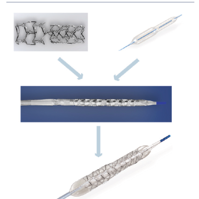 BiOSS® Stent and Bottle® Balloon Structures