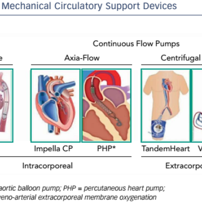  Mechanical Circulatory Support Devices