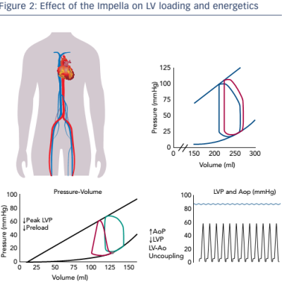 Effect of the Impella on LV loading and energetics