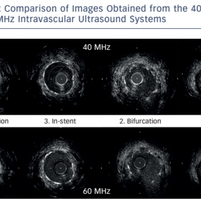 Comparison of Images Obtained from the 40 MHz and 60 MHz Intravascular Ultrasound Systems