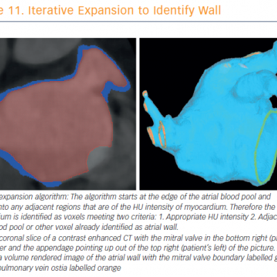 Iterative Expansion to Identify Wall