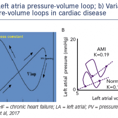 a Left atria pressure-volume loop b Variation in left atrial pressure-volume loops in cardiac disease