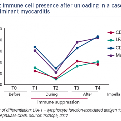 Immune cell presence after unloading in a case of acute fulminant myocarditis