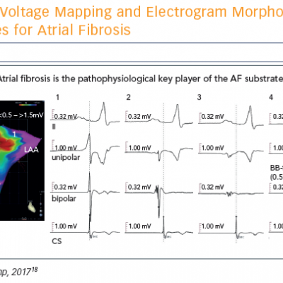 Voltage Mapping and Electrogram Morphology as Surrogates for Atrial Fibrosis