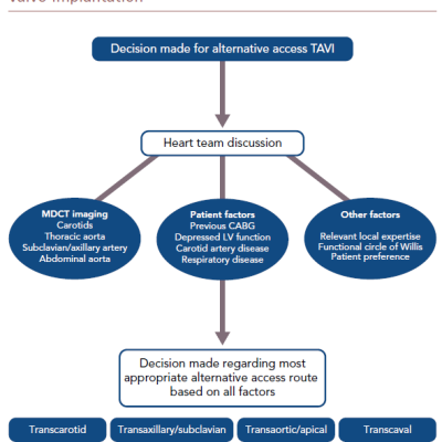 Proposed Algorithm For Decision-Making Regarding