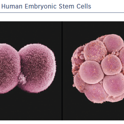 Human Embryonic Stem Cells