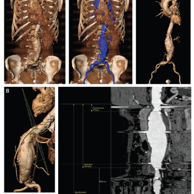 Figure 1 Representative Images from 3D Computed Tomography Workstation