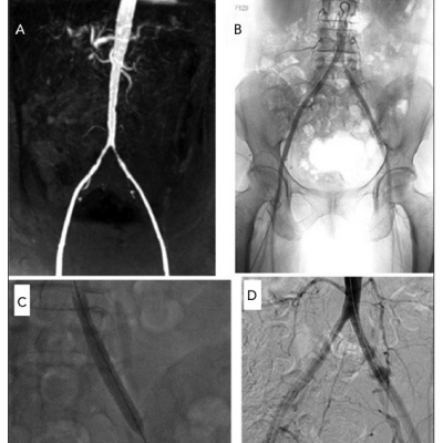 Imaging in Case 1