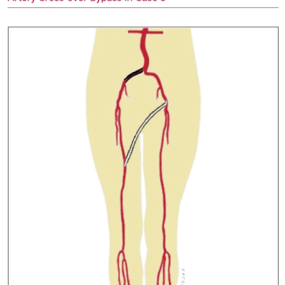 Schematic Diagram of Left Common